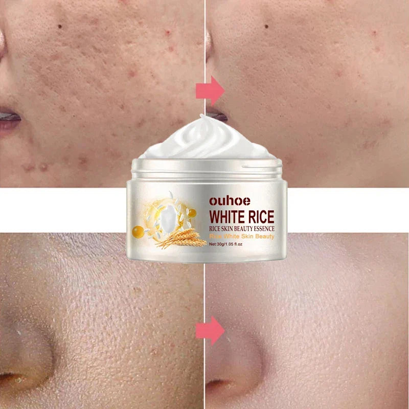 Creme Facial Antirrugas de Arroz – Tratamento para Acne, Melasma e Clareamento - Compre 1 e Leve 3